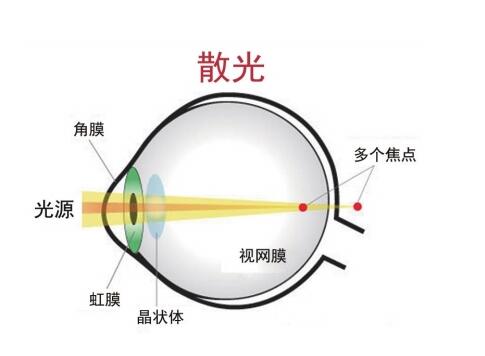 如何判斷自己是否患有散光？