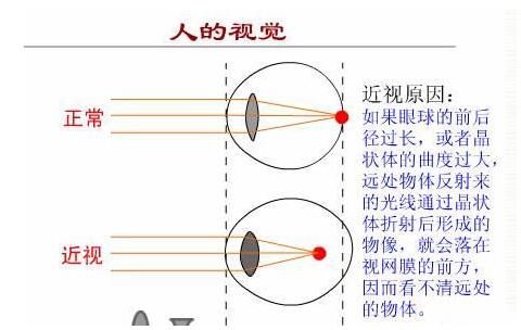 如何判斷自己是否患有散光？