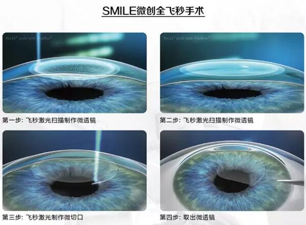 2017新加坡近視手術(shù)專家巡診.南昌站圓滿落幕