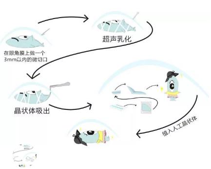 十張漫畫讓你更了解白內(nèi)障！